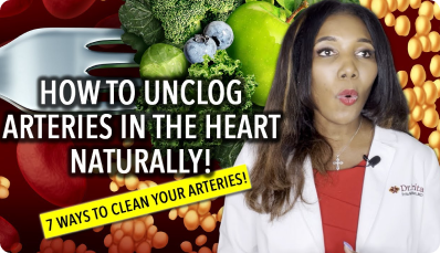 Unclog Arteries In The Heart Naturally- 7 Ways To Clean Your Arteries!