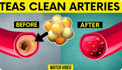 Only 5 Teas That Clean Arteries, Normalize High Blood Pressure & Prevent Heart Attack